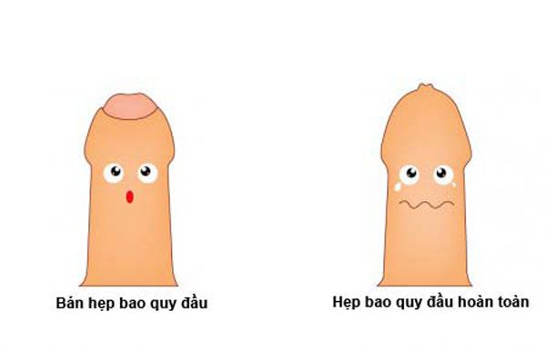 Bệnh Sinh Dục Nam Giới Thường Gặp Và Các Dấu Hiệu Nhận Biết 1 bệnh sinh dục nam giới thường gặp